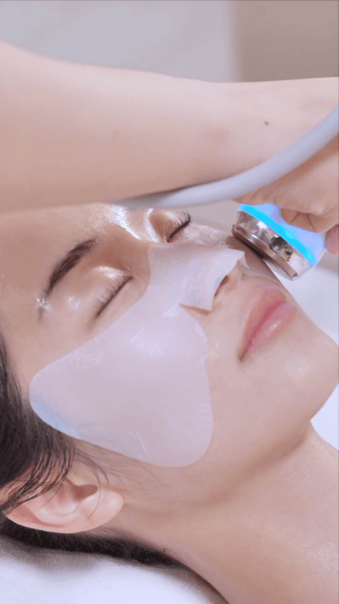 Điện di lạnh thẩm thấu khóa ẩm